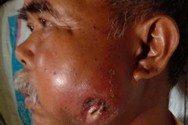 Derita Jana, Warga Rimbo Data Sungai Nanam, Butuh Peduli Bersama.