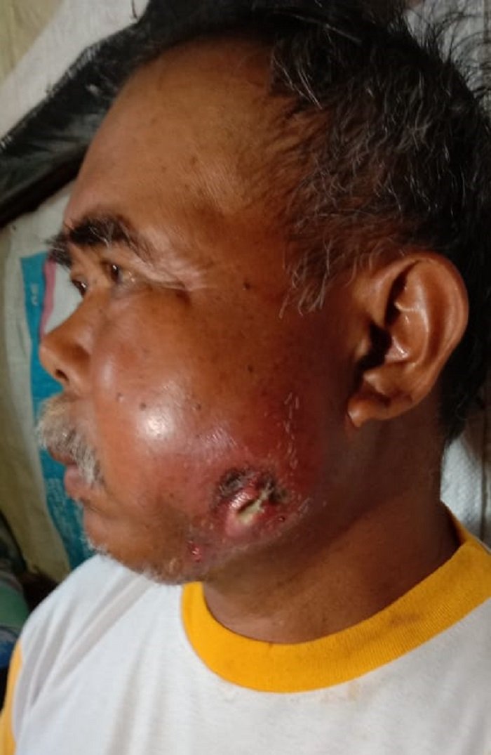 Derita Jana, Warga Rimbo Data Sungai Nanam, Butuh Peduli Bersama.