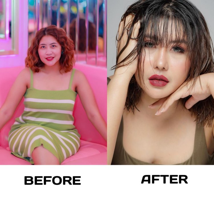 Operasi Kedua di Korea Selatan, Aprilia Sky Tampil Lebih Muda dan Percaya Diri